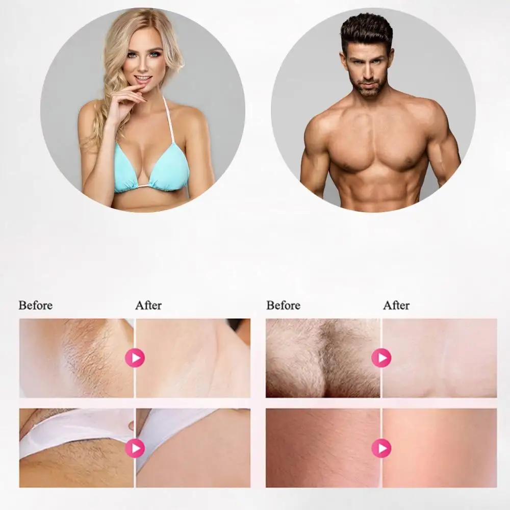 Epilator (Bäst i test) - Bild 6